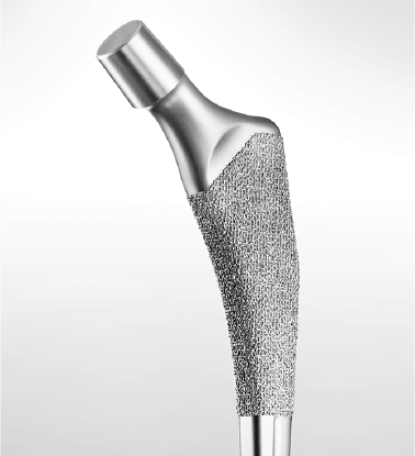 Pure titanium porous coated on Ti-6Al-4V femoral stem implant