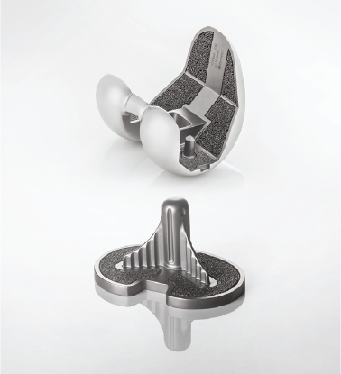 Pure titanium porous coated on CoCr knee implant